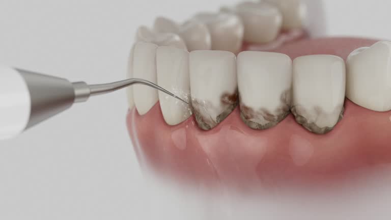Reliable Root Canal Treatment contractor in Wilkes County County, NC by Dentist Open Now